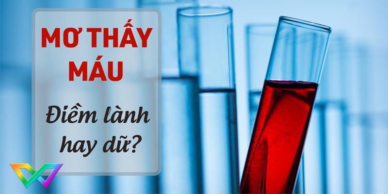 mo-thay-mau-nen-danh-con-gi-de-trung